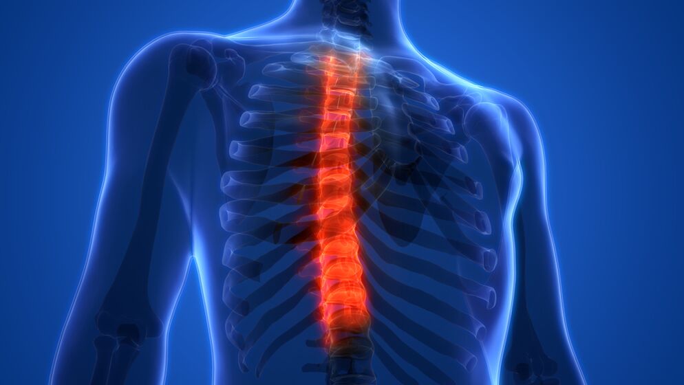 osteochondróza hrudnej chrbtice