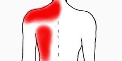 bolesť pod ľavou lopatkou zozadu